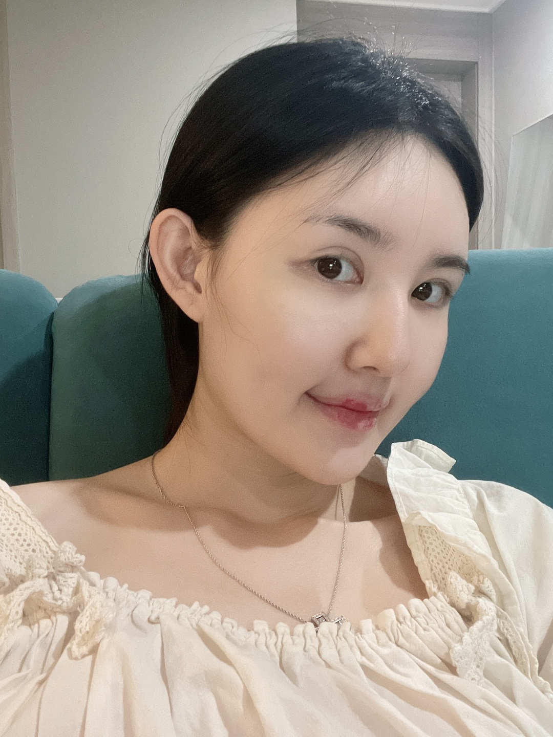 코성형 전 사진 1
