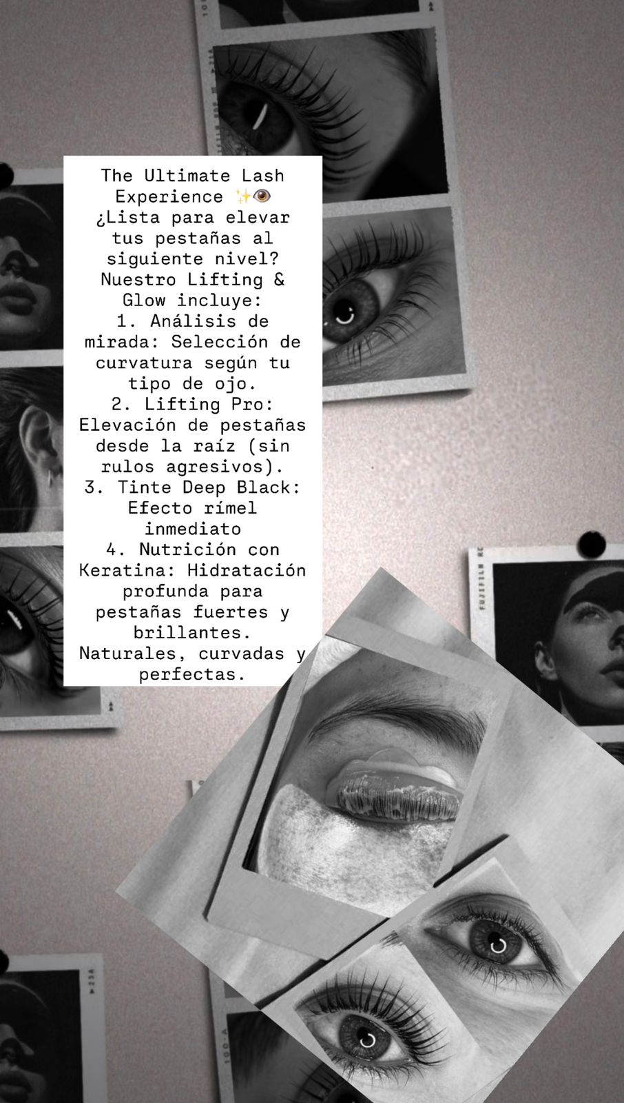 VD