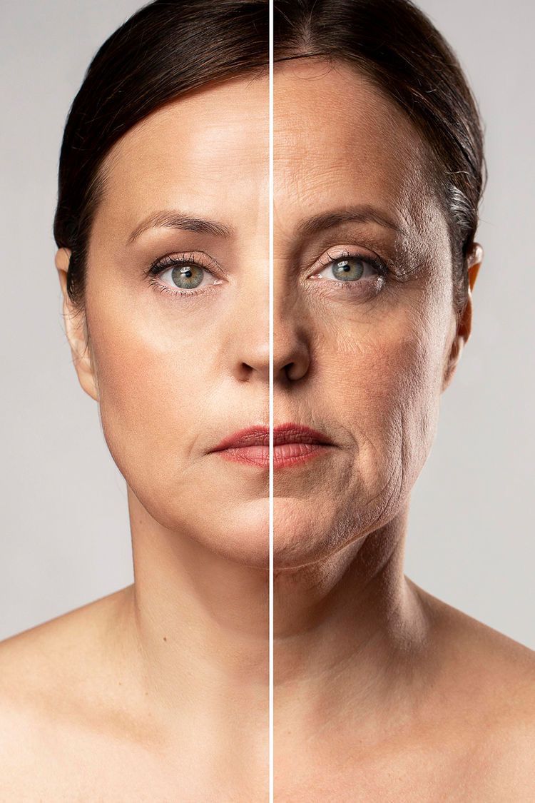 Hautverjüngung mit Plasma & Quantenbehandlung