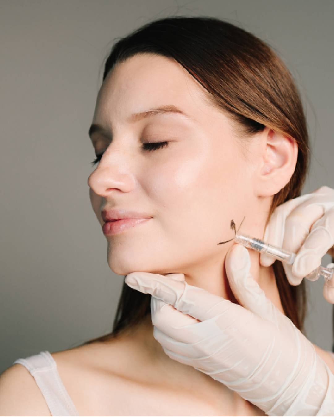 Crow's feet treatment area