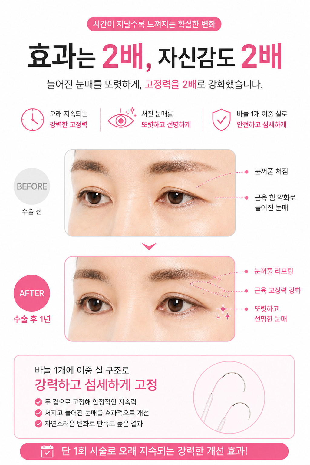 추가 이미지