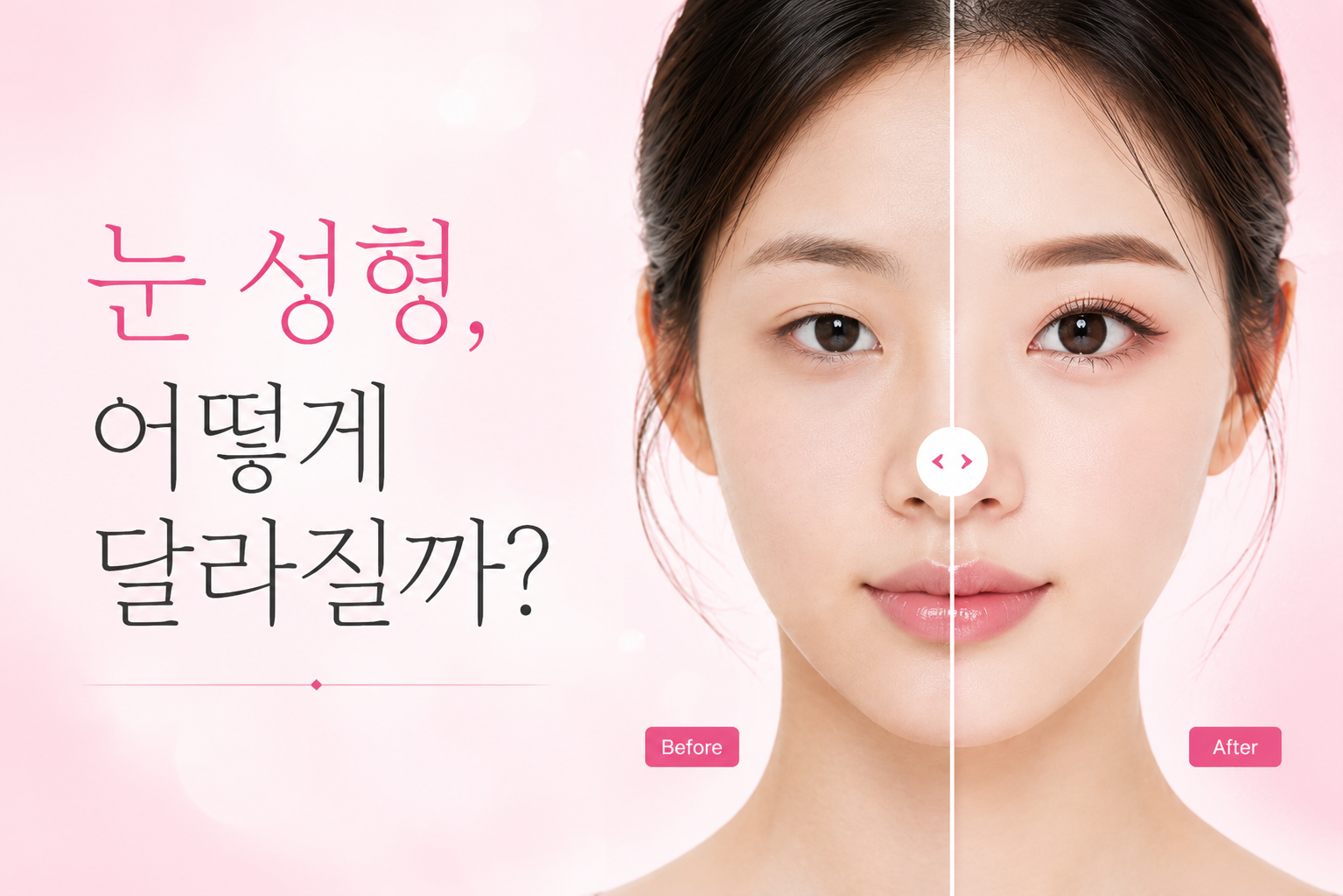 눈 성형 이벤트 히어로 배너