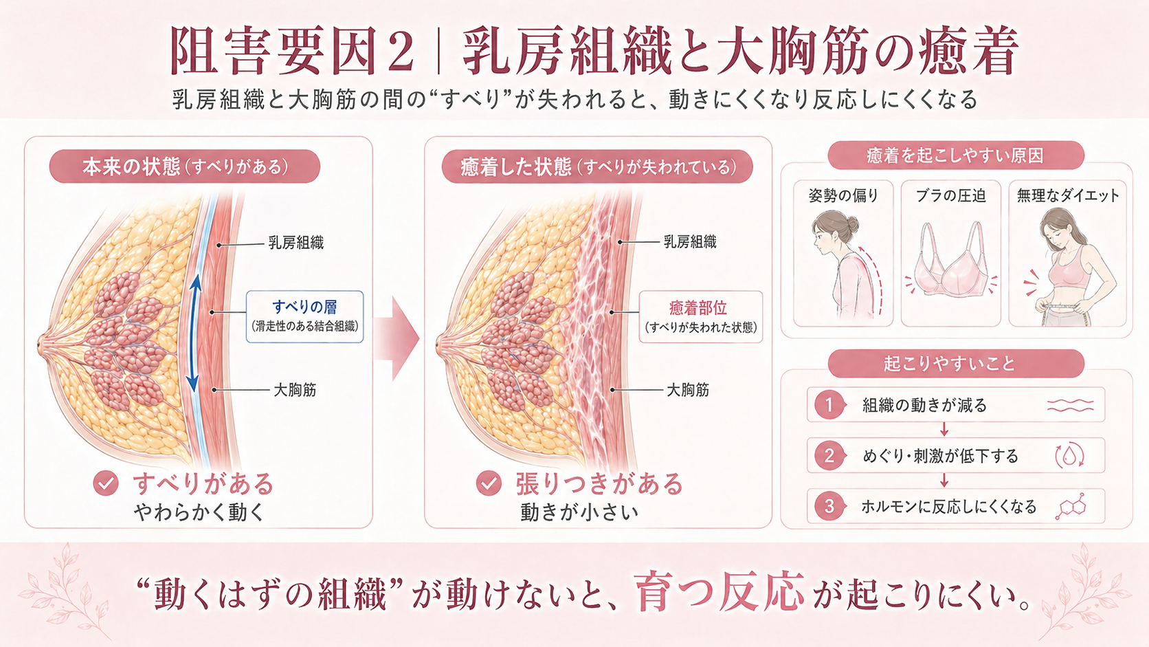 乳房組織と大胸筋の癒着の比較図(健康 vs 癒着)