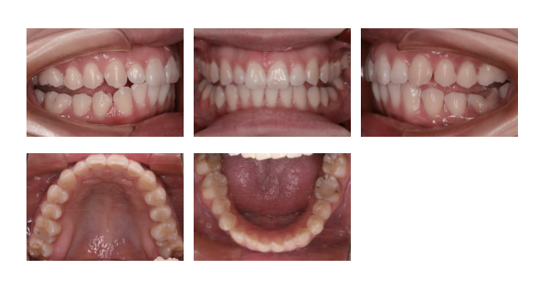 骨格バランスの調整