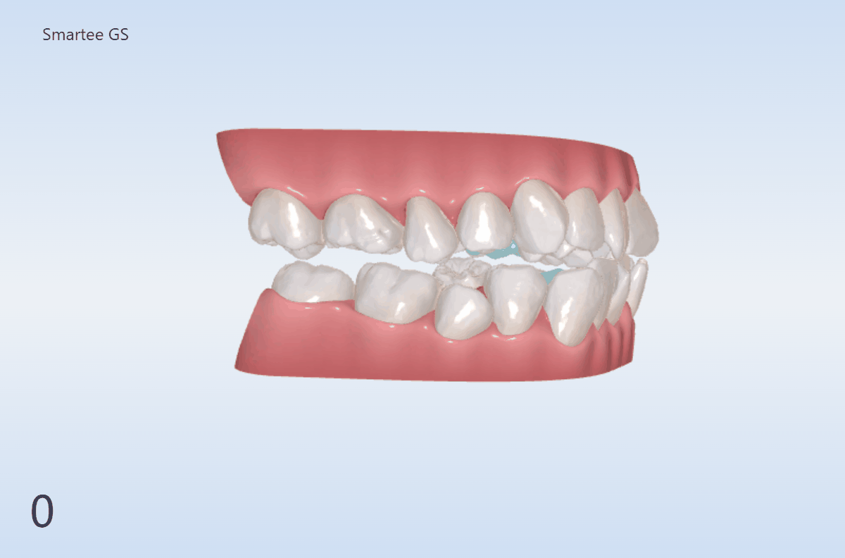 横顔シミュレーション