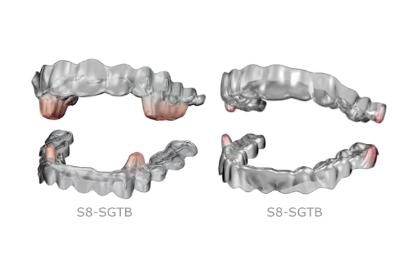 顎位再建(フェーズ1)