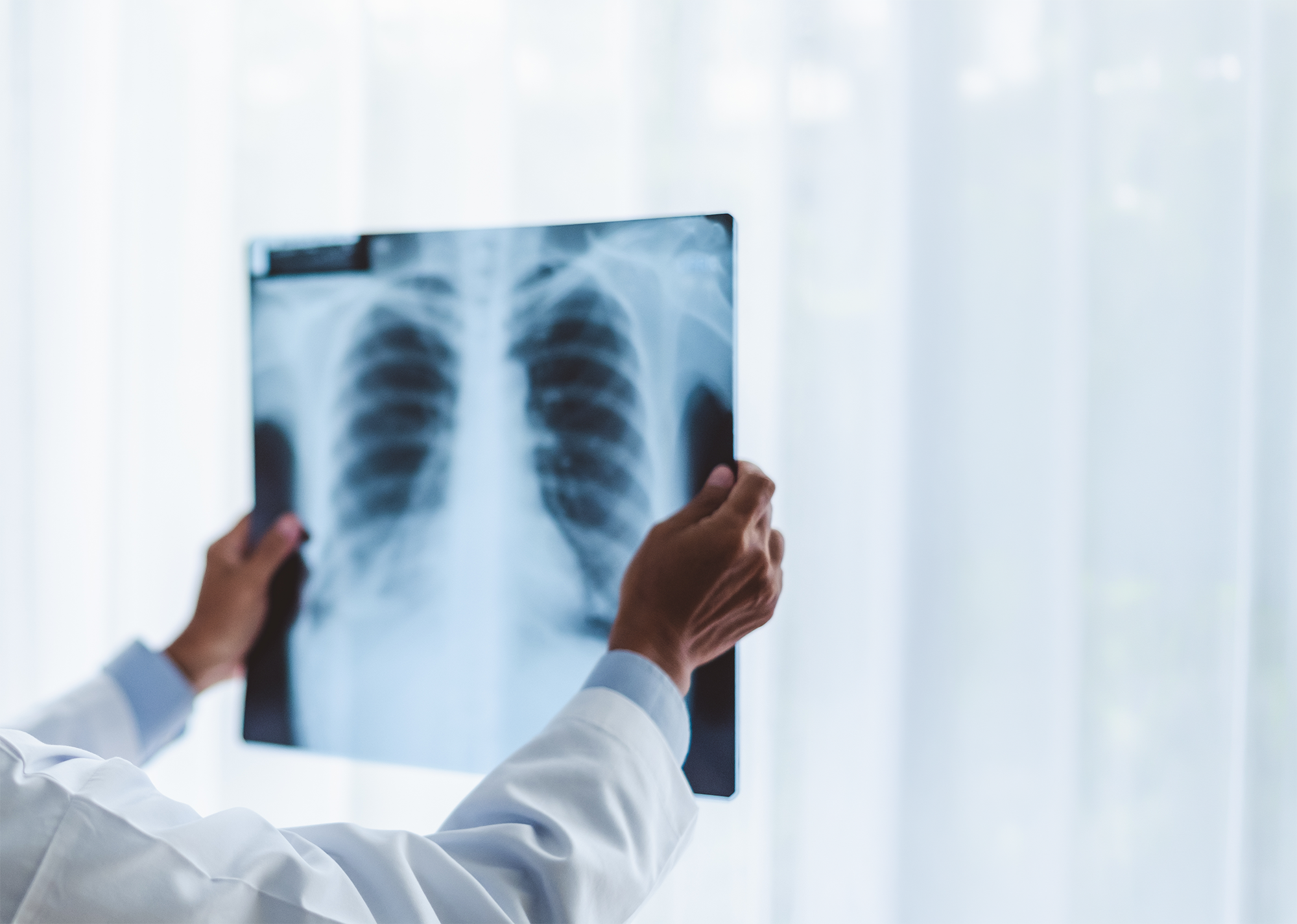 慢性閉塞性肺疾患(COPD)