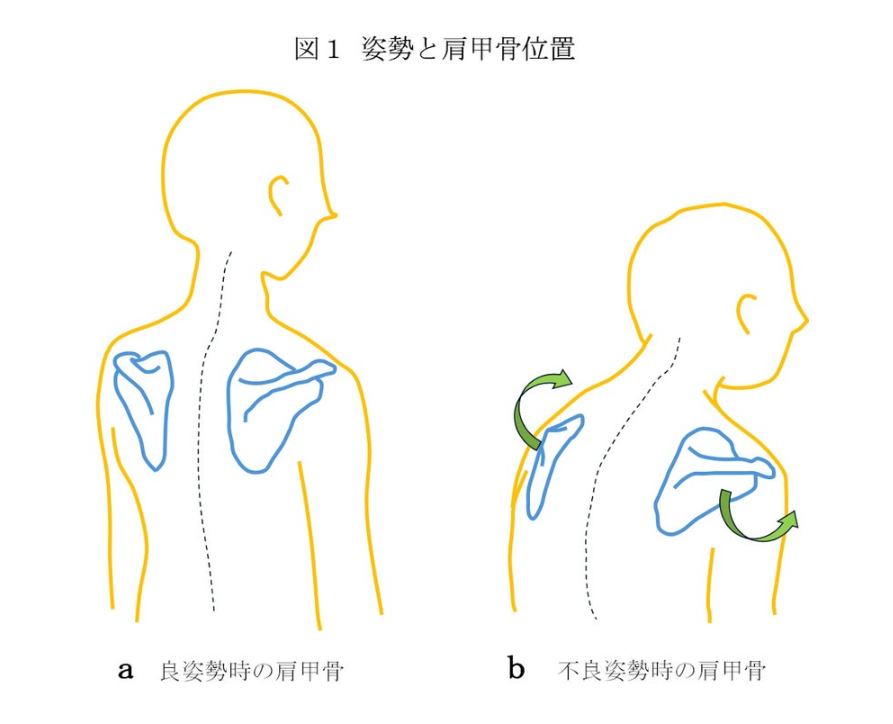 胸椎・肩甲帯の硬さがストレートネック・首こりを引き起こす姿勢連鎖の医学博士監修図解