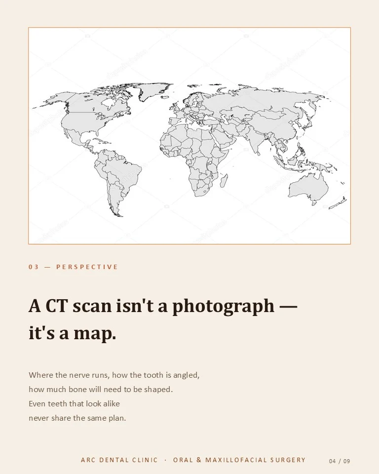 CT不是照片,而是地图