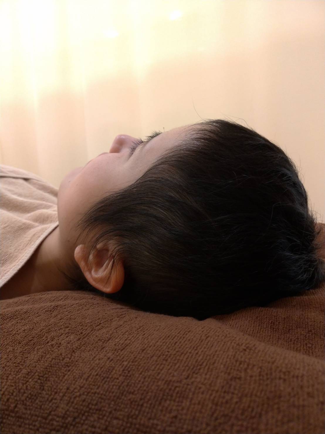 一年後更に改善がみられたが、就職がきっかけで、少し悪化。この時点で、鍼灸治療の限界を感じる。2年程経ってから特殊周波数治療を開始。半年経たずして劇的改善。後は髪が伸びるのを待つだけの状態に。