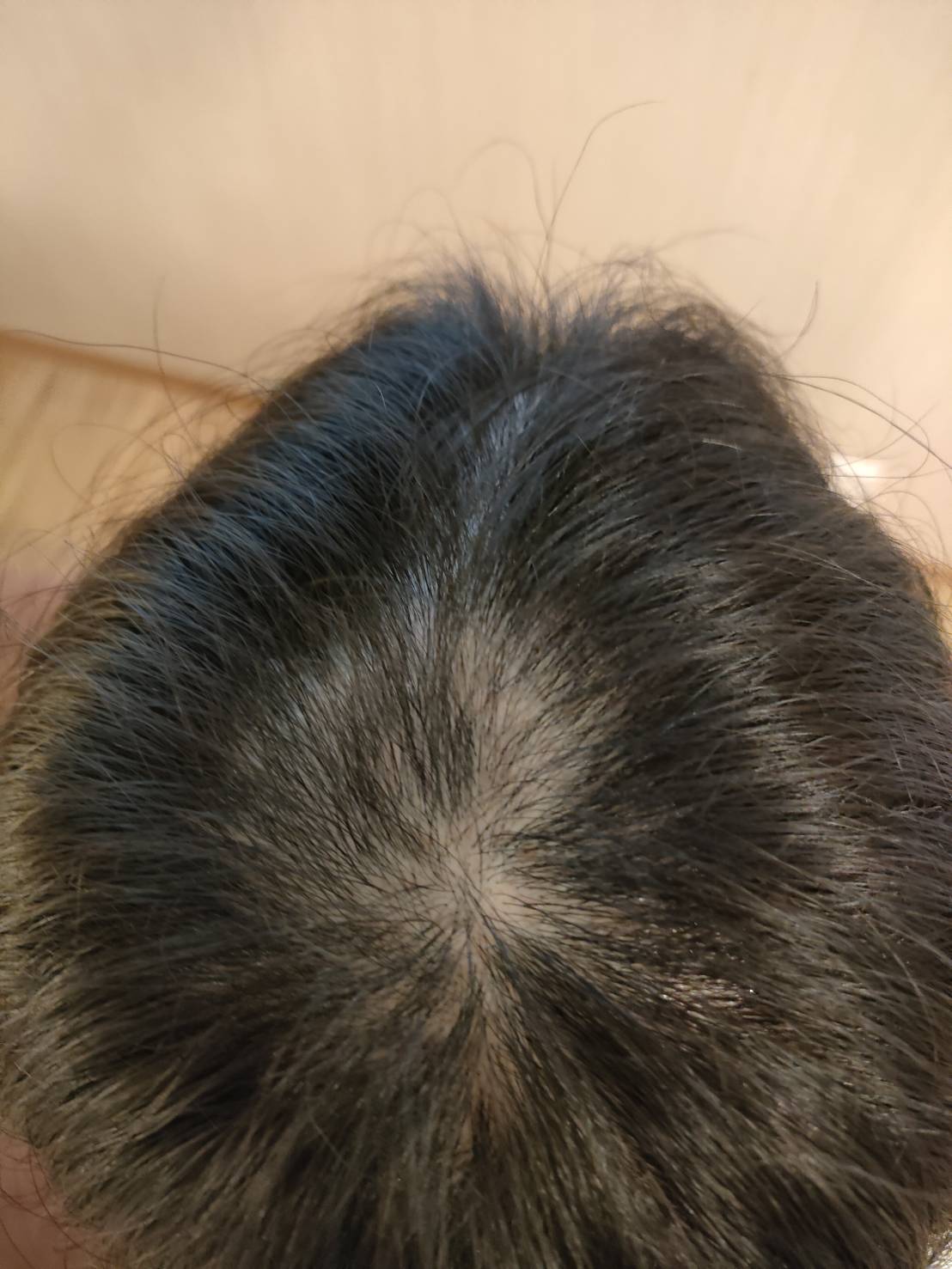 約5ヶ月で治療終了。