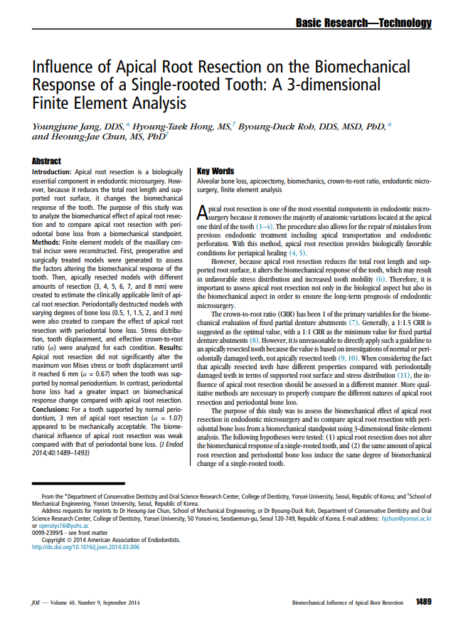 Influence of apical root resection on the biomechanical response — Part 2: combined with periodontal bone loss.