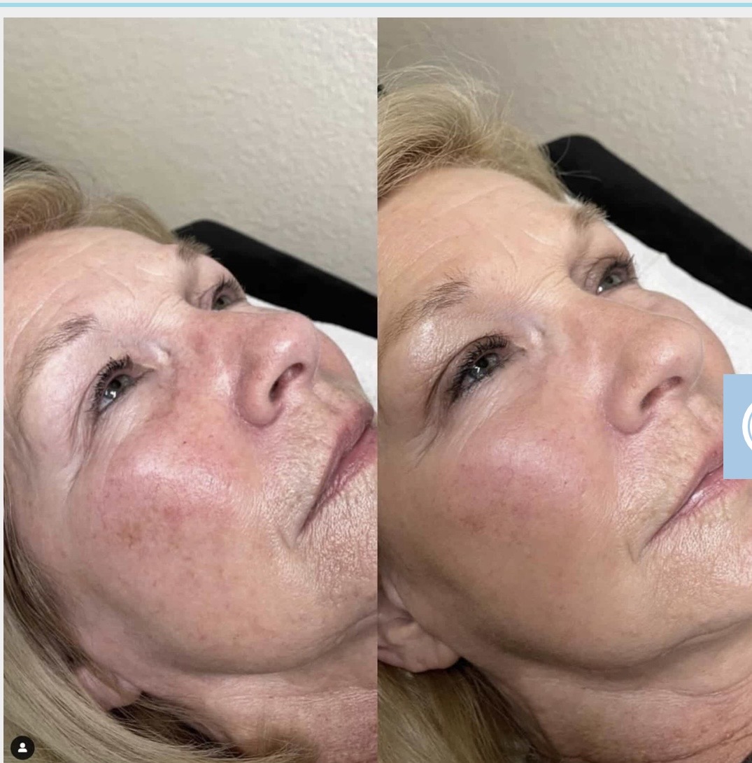 Client result 1
