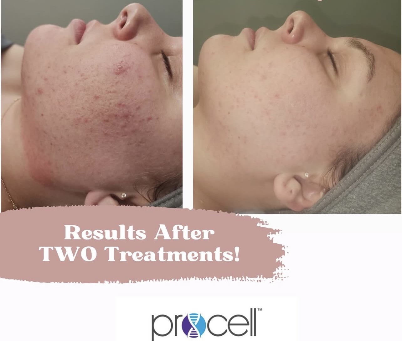 Client result 3