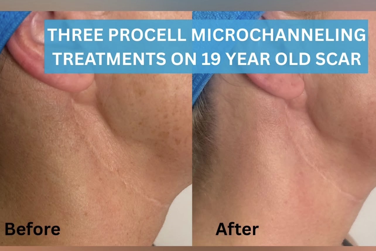 Client result 5