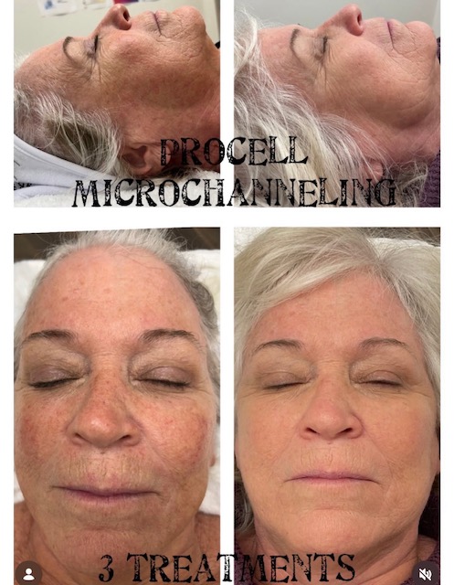 Client result 6
