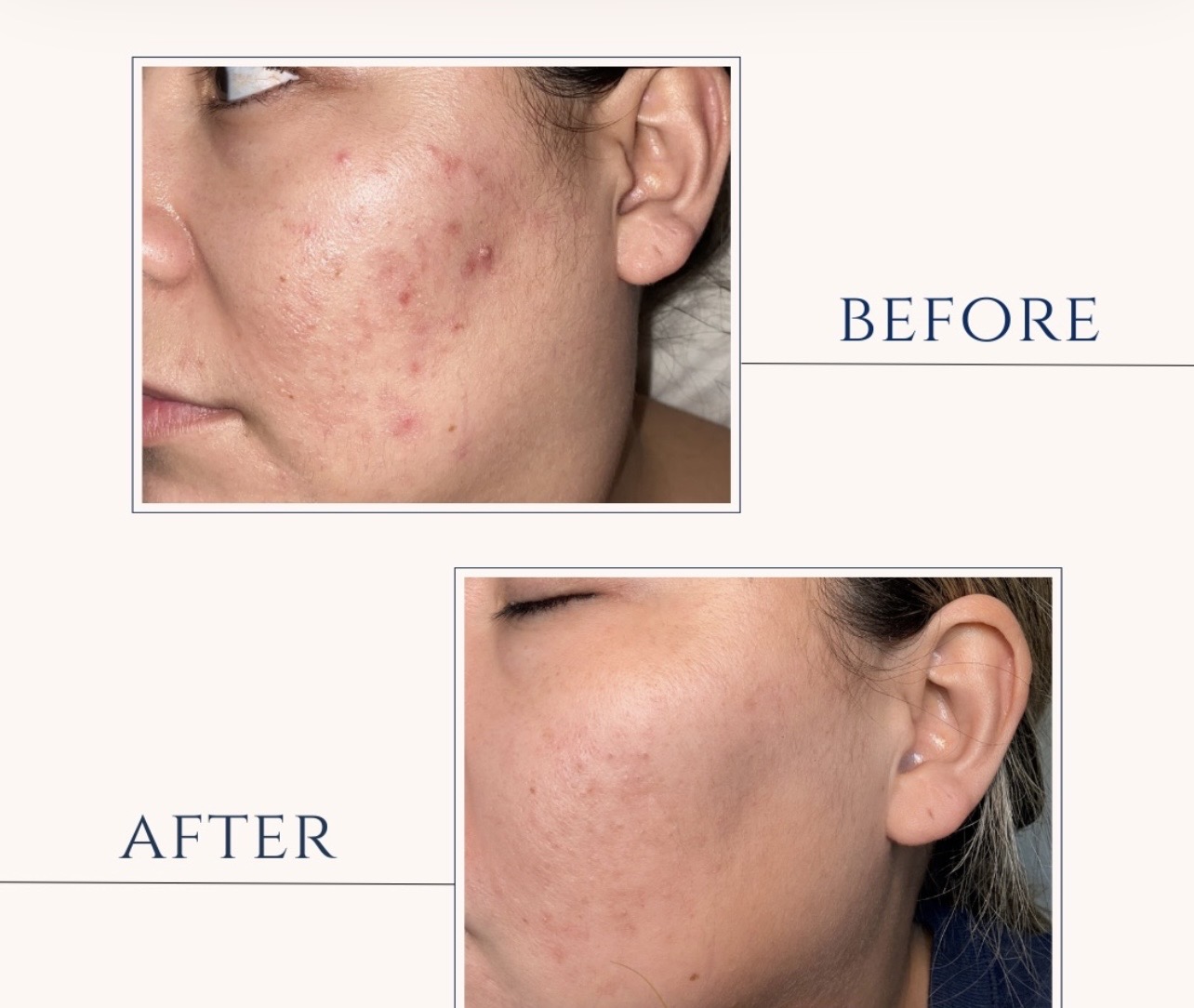 Client result 4