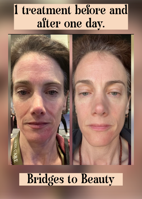 Client result 2