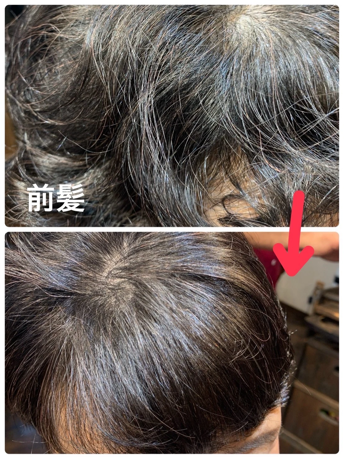 前髪周辺のビフォーアフター
