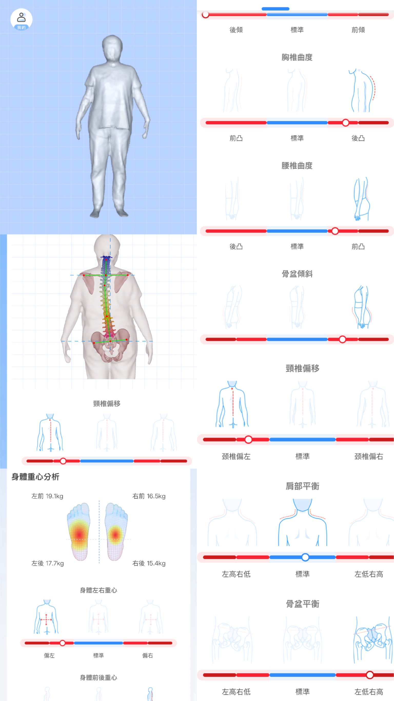 台中3D脊柱檢測 體態分析 Elite Pilates